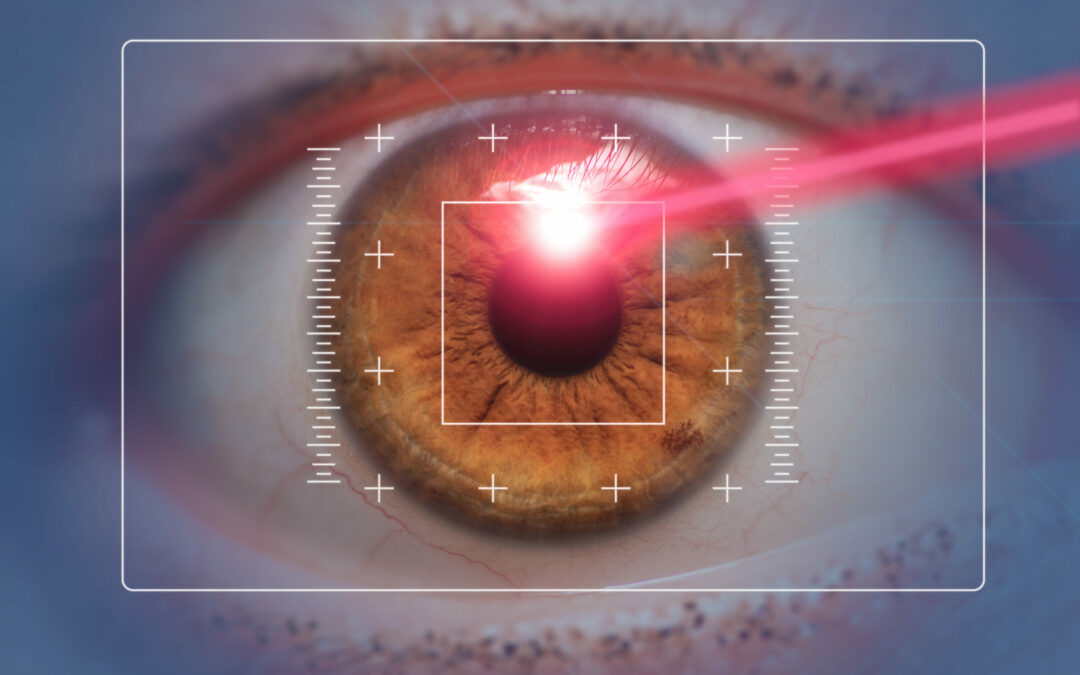 LASIK Eye Surgery Explained
