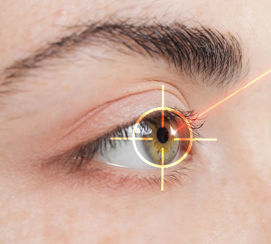 The Complete Guide to LASIK Eye Surgery: Everything You Need to Know